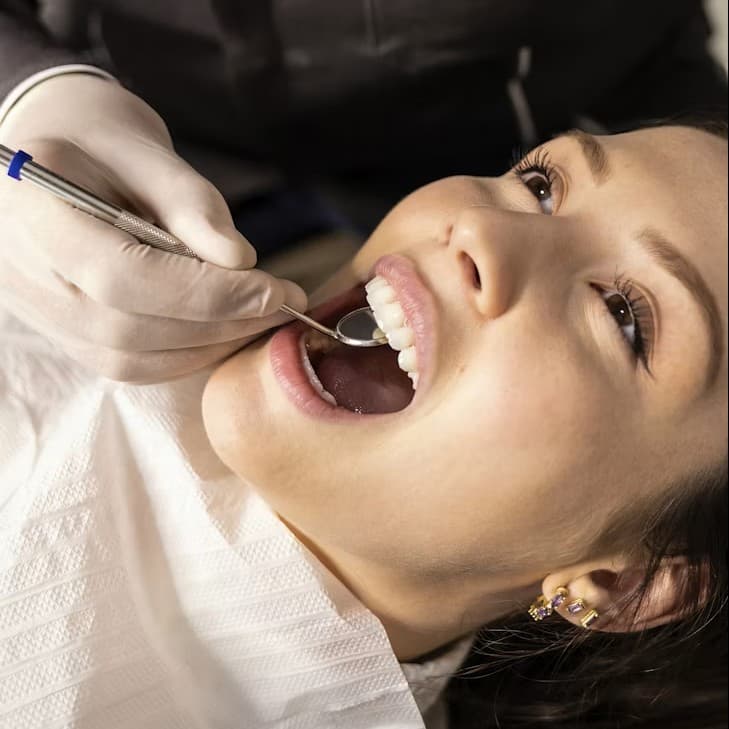 Limpieza dental en Rincón de Milberg